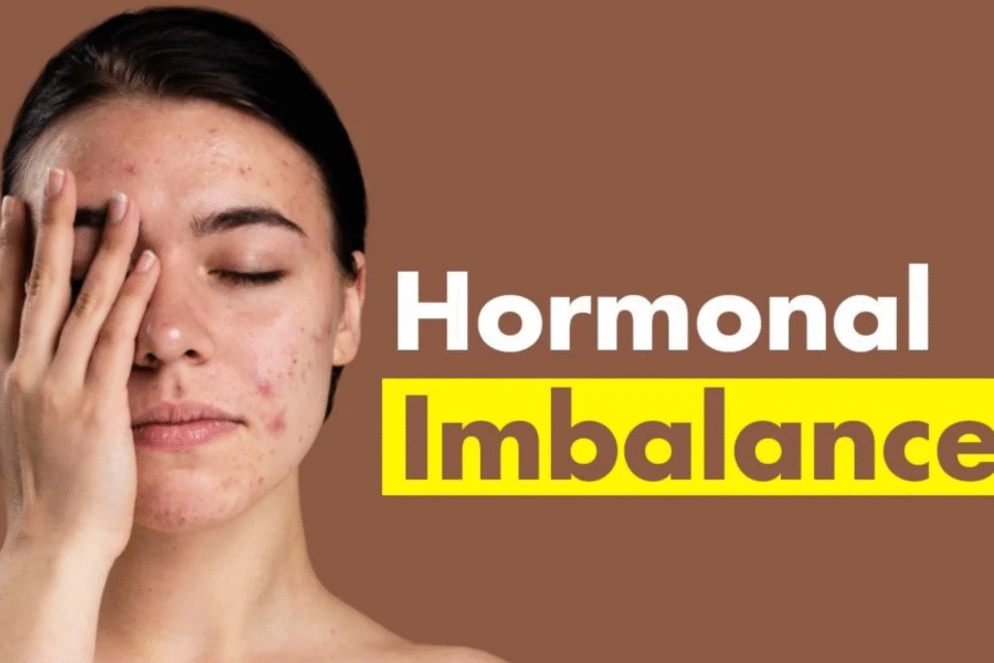 Hormonal Imbalance